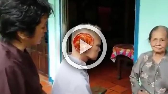 VIDEO - Awalnya Mimisan, Lama-Kelamaan Penyakit Aneh Gerogoti Wajah ...