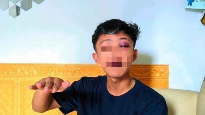 Abdul Aziz menceritakan kejadian yang menimpanya dianiaya oknum polisi pada Selasa (31/1/2024)