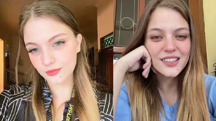Andrea Henriette seleb TikTok yang 15 tahun gak bisa minum air putih