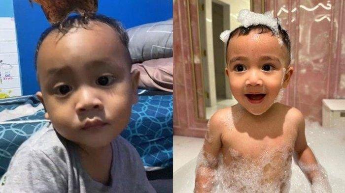 Balita berwajah mirip Rayyanza alias Cipung