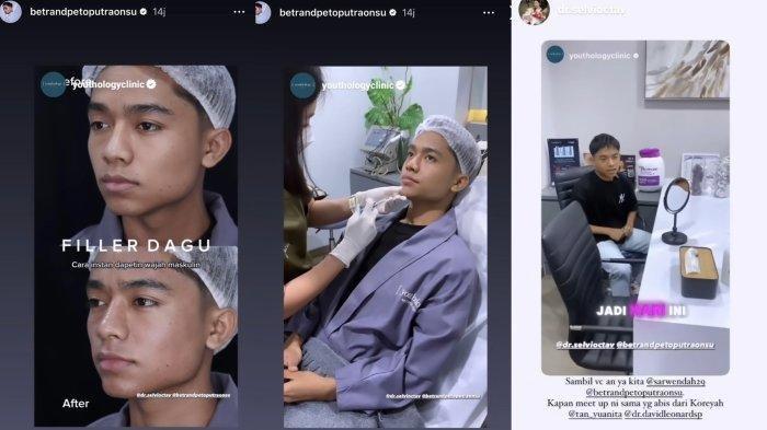 Betrand Peto rombak wajah usai Sarwendah operasi plastik di Korea. (Instagram betrandpetoputraonsu)