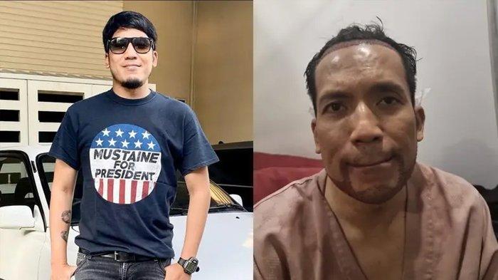 Biaya Desta Transplantasi Rambut dan Brewok, Usaha Ubah Penampilan Setelah Cerai dari Natasha Rizky