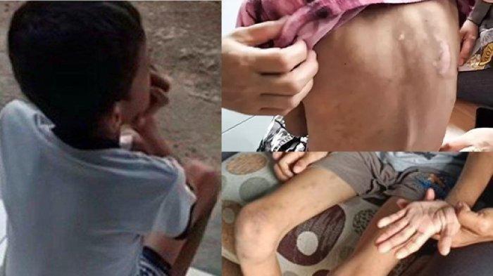 Bocah 11 Tahun Ini Diduga Makan Kerikil Gegara Tak Diberi Makan Orang Tuanya, Sering Dipukul Juga