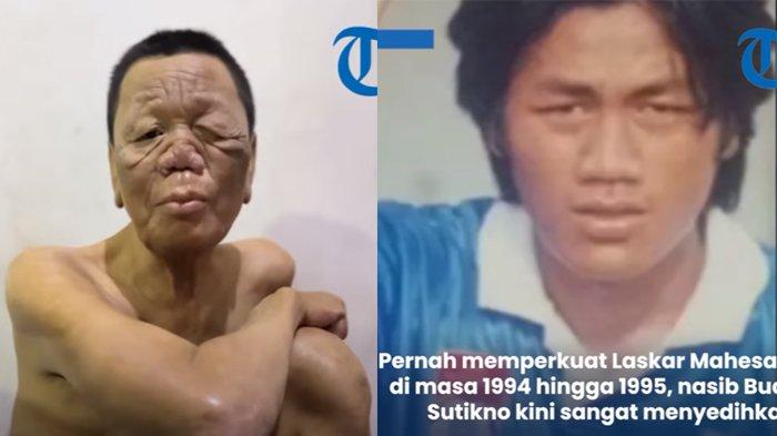 Budiono Sutikno mantan pemain PSIS Semarang sekarang (kiri) dan dulu (kanan)