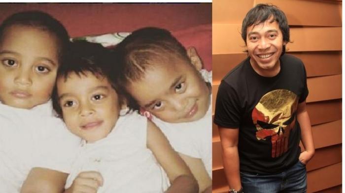 Cerita Anak Komeng Meninggal Usia 10 Tahun Karena Tersedak Mi, Meninggal di Pangkuan Sang Kakak