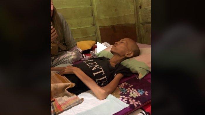 Fakta Kabar Lilis Karlina Sakit Parah Hingga Tubuhnya Kurus Kering