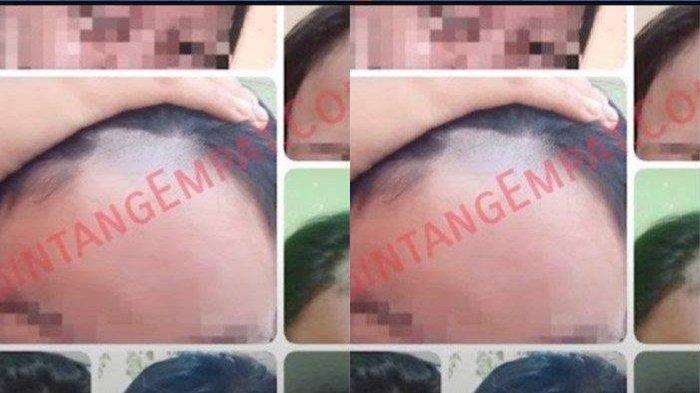 Guru Bahasa Inggris Gunduli 19 Siswi SMP di Lamongan Kini Dinonaktifkan