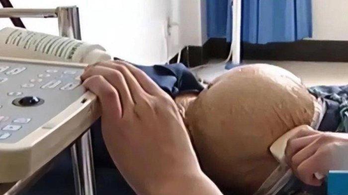 Hoang Nghia Quan, wanita 91 tahun hamil terdeteksi setelah dilakukan USG