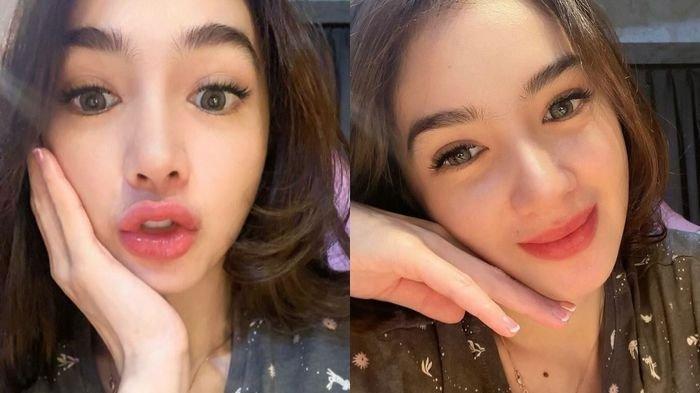 Potret cantik Angel Karamoy usai oplas hidung
 