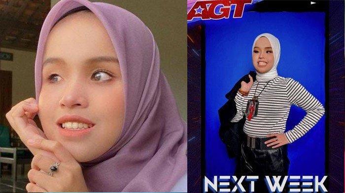 Kehidupan Sekolah Putri Ariani Meski Satu-satunya Siswi Disablitas, Terkenal Ramah, Suka Tantangan


Kehidupan Sekolah Putri Ariani Meski Satu-satunya Siswi Disablitas, Terkenal Ramah, Suka Tantangan
