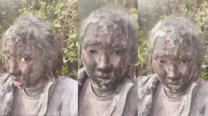 Kondisi Zhafirah Zahrim Febrina pendaki terjebak saat Gunung Marapi erupsi