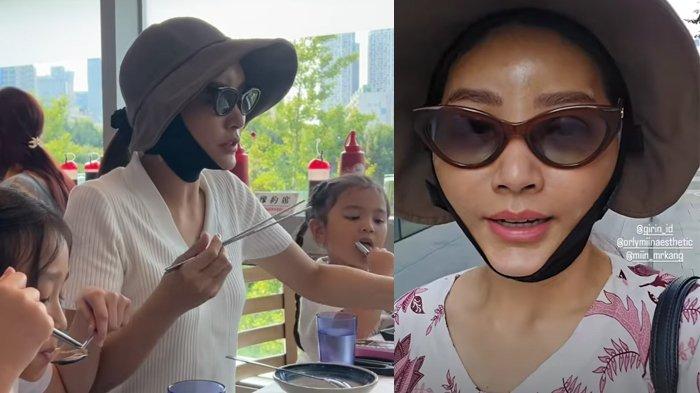 Kondisi wajah Sarwendah lebam setelah operasi plastik belibur di Korea Selatan