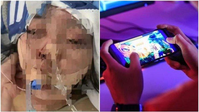  Korban KDRT Lao Chunxue (28) dari Mongolia Dalam di China utara. (Baidu)