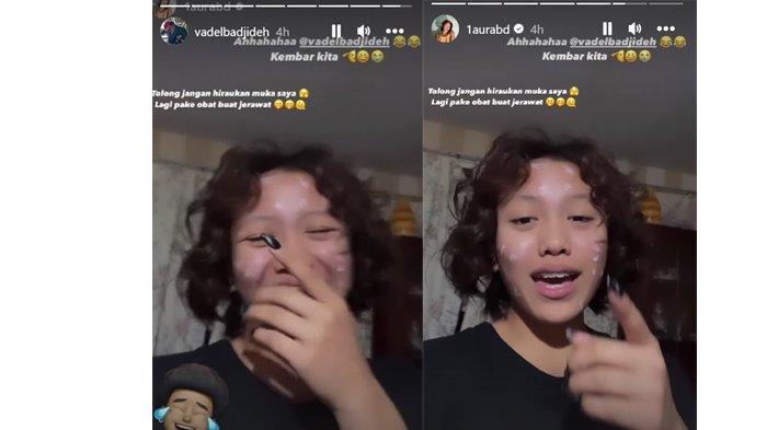 Lolly saat menirukan gaya rambut kekasihnya Vadel