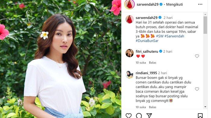 Penampilan Sarwendah Sebulan Setelah Oplas, Dulu Disebut Mirip Inul Daratista, Kini Mirip Siapa?