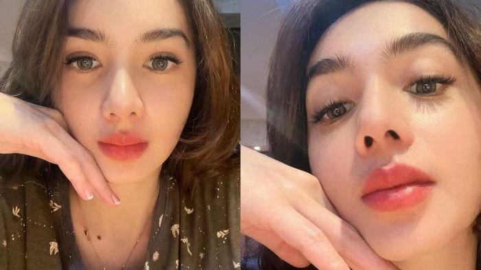 Potret cantik Angel Karamoy usai oplas hidung
 