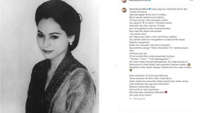  Ratna Sari Dewi curhat soal kulitnya mulai keriput