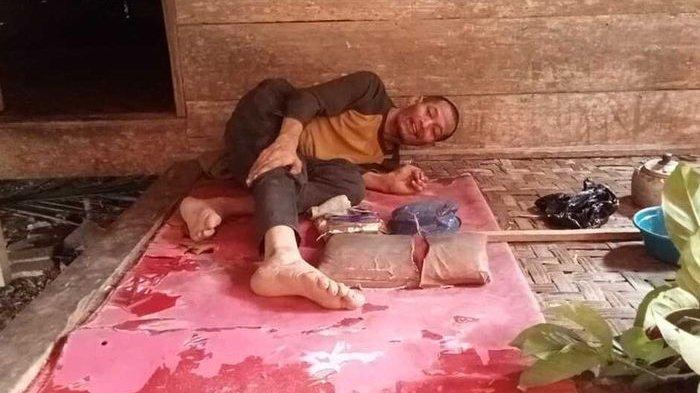 Satu keluarga di Kabupaten Lebak, Provinsi Banten mengalami kelumpuhan kaki 1