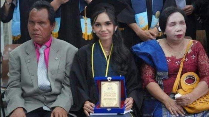 Septiana H Pasaribu didampingi kedua orangtuanya saat mengikuti prosesi wisuda di Universitas HKBP Nommensen Kota Pematang Siantar, Rabu (6/12/2023). (TRIBUN MEDAN/HO) ((TRIBUN MEDAN/HO))