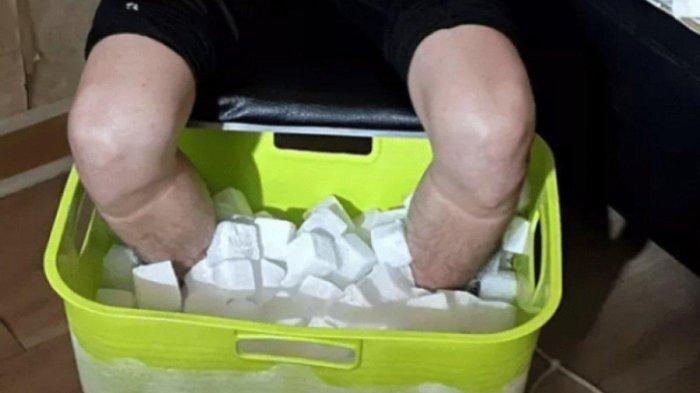 Sosok mahasiswa di Taiwan nekat rendam kaki di es kering hingga diamputasi demi dapat asuransi