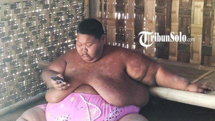Sungadi, pemuda asal Desa Sono, Kabupaten Sragen yang mengidap obesitas