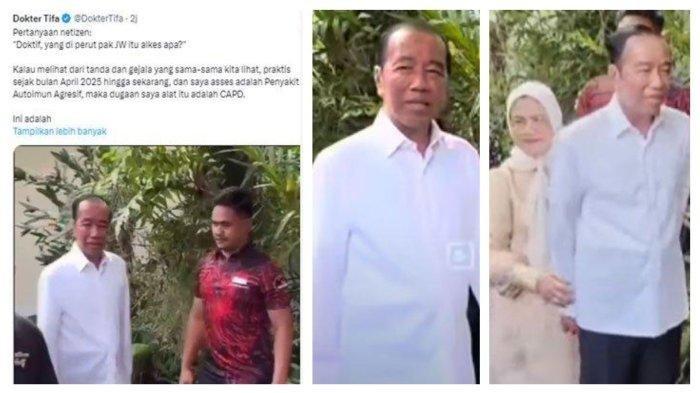 PERUBAHAN WAJAH JOKOWI: Tangkapan layar cuitan Dokter Tifa soal kondisi wajah Jokowi yang memprihatinkan, Minggu (22/6/2025). Selain itu Dokter Tifa juga soroti bagian perut Jokowi.