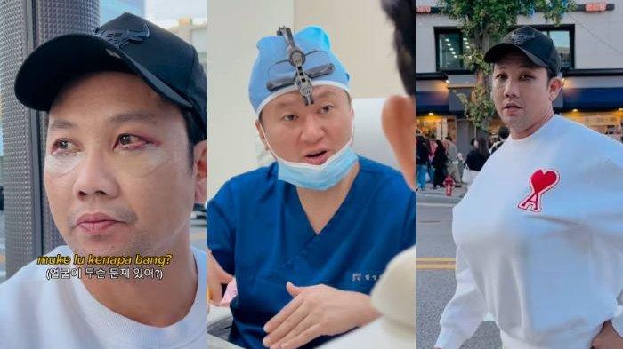Unggahan Denny Sumargo setelah operasi plastik atau oplas di Korea