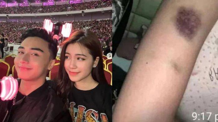 Viral Isi Chat Rinoa Aurora Pacar Leon Dozan, Menangis Dianiaya, Sembunyi di Toilet Minta Tolong