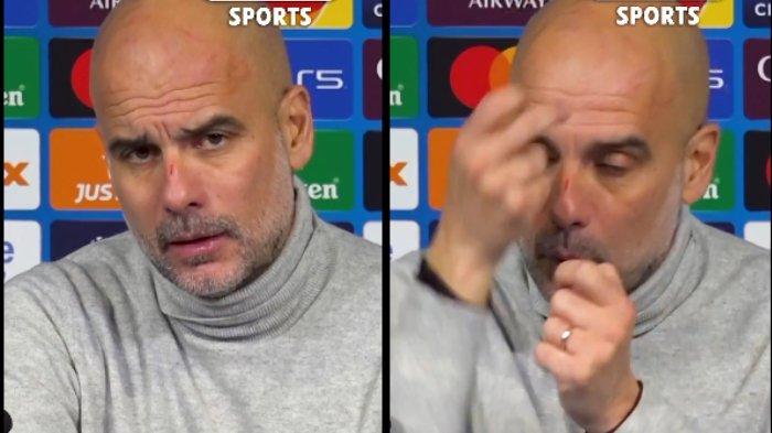 Pelatih Manchester City, Pep Guardiola, mengalami luka di hidung