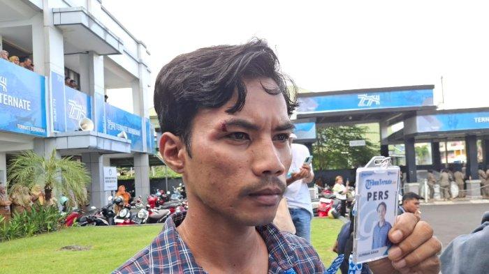 KEKERASAN JURNALIS - Jurnalis Tribun Ternate M. Julfikram Suhadi dipukul oknum Satpol PP saat meliput aksi mahasiswa di depan Kantor Wali Kota Ternate, Senin (24/2/2025).