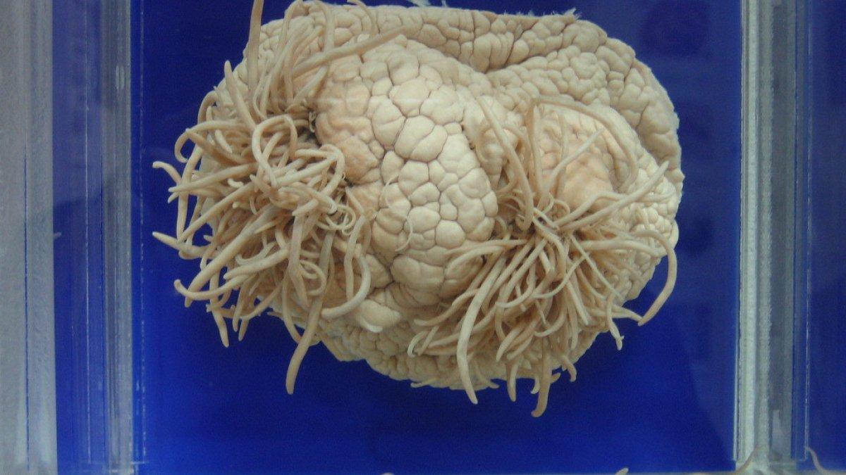 Museum Parasitologi Meguro, satu tempat wisata gratis di Tokyo Jepang yang bisa kamu kunjungi.