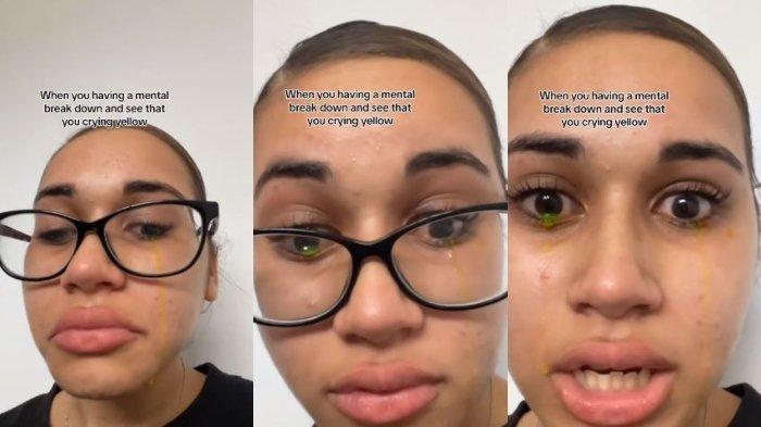 Seorang wanita menangis mengeluarkan air mata berwarna kuning.