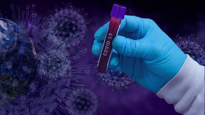 Ilustrasi virus. Peneliti Tiongkok telah memicu kontroversi di komunitas ilmiah setelah mereka menerbitkan penelitian tentang virus mutan terkait virus corona dengan tingkat kematian 100 persen pada tikus rekayasa genetik yang mencerminkan susunan genetik serupa dengan manusia.
