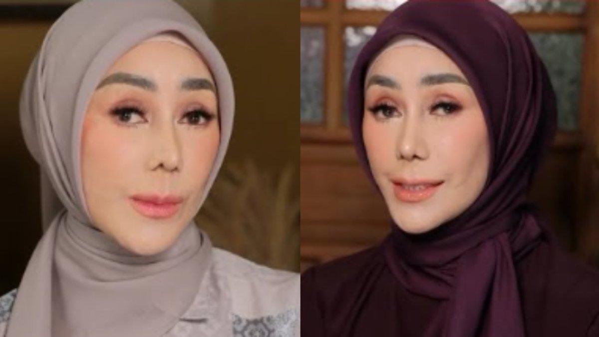 AMY QANITA OPLAS?,- Amy Qanita diduga operasi plastik hidung dan dagu, ibu Raffi Ahmad disebut mirip Michael Jackson.