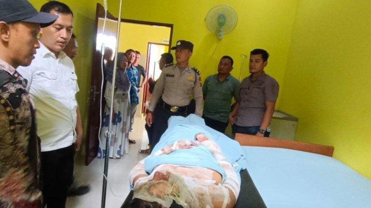 ANH, wanita yang dibakar suami, dirawat di Puskesmas Pangkalan Brandan, Kabupaten Langkat, Kamis (5/10/2023). Peristiwa suami bakar istri ini dilatarbelakangi rasa cemburu.