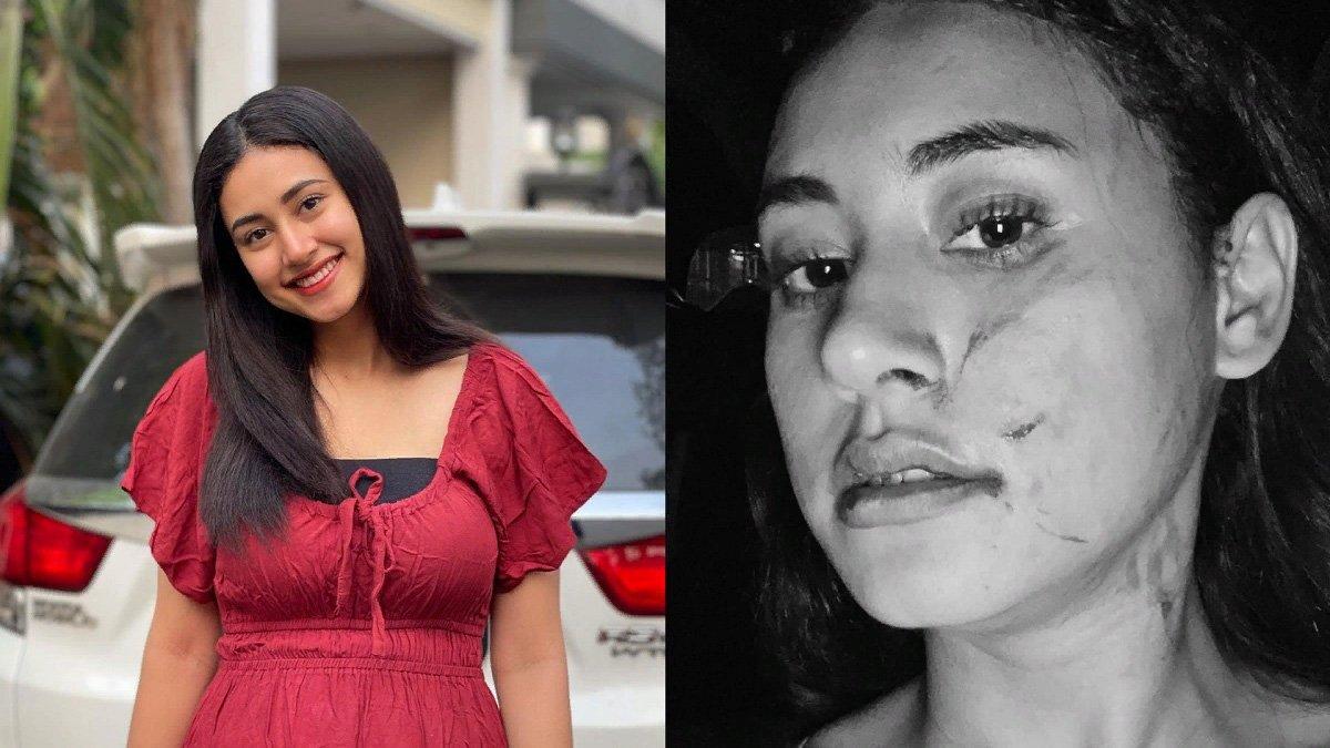 Afifah Riyad curhat dihajar mantan pacar suami.