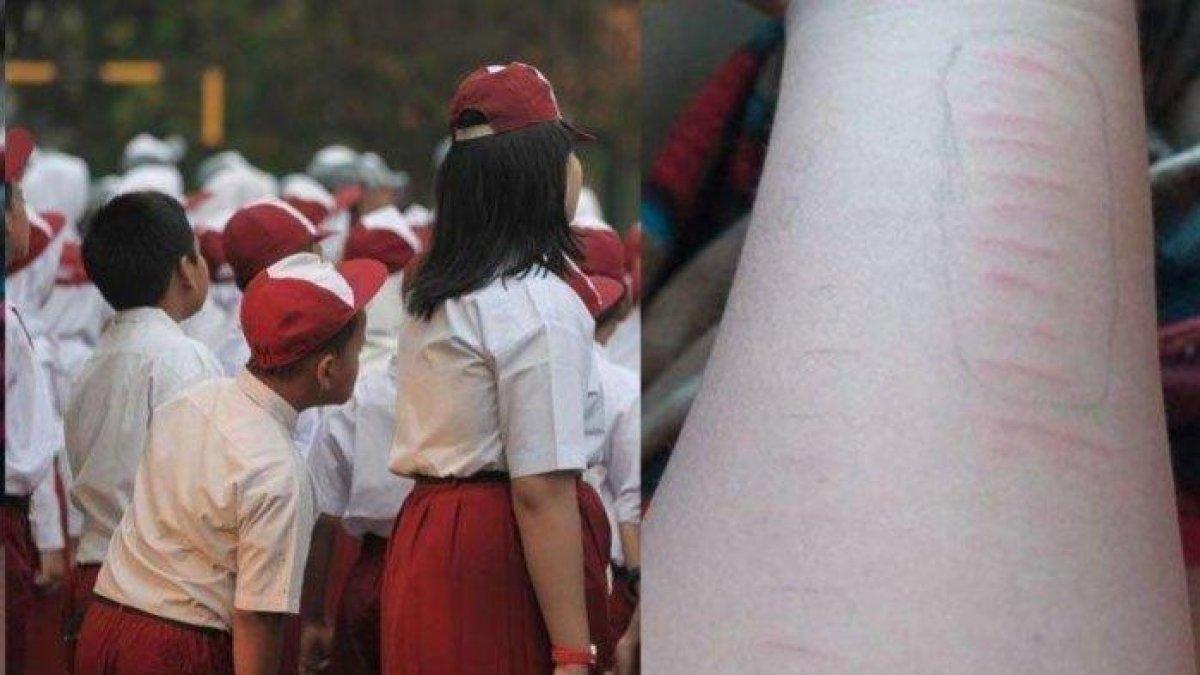 Anak SD sayat tangan mereka sendiri,