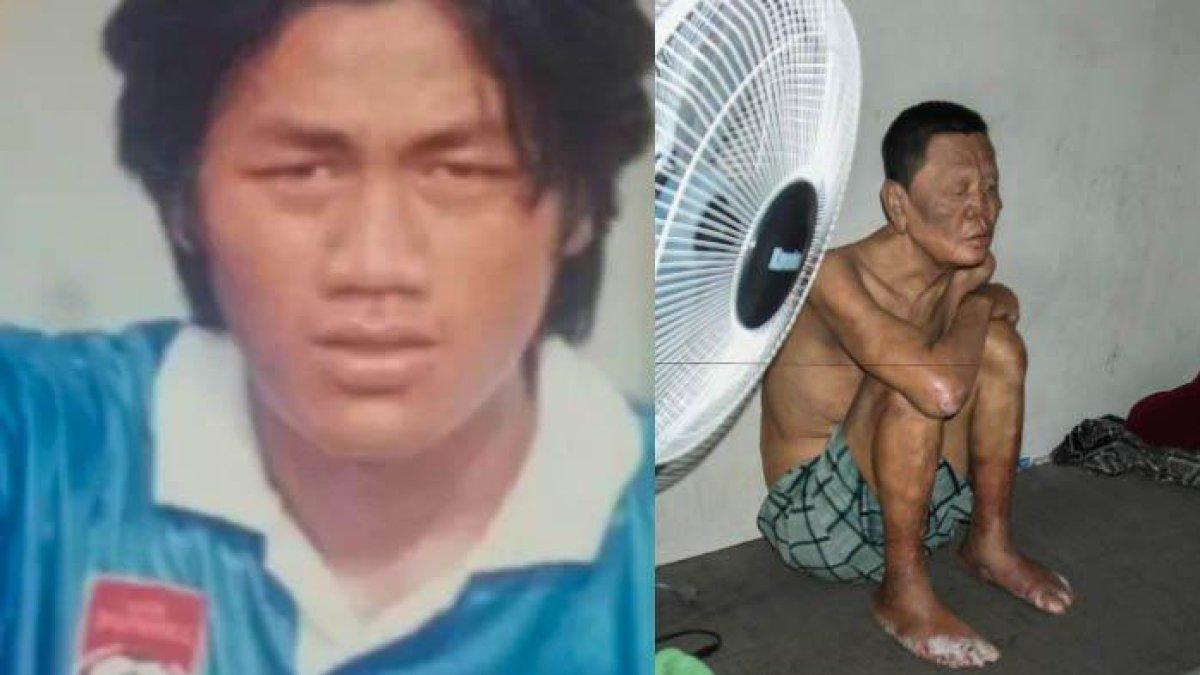 Anak mantan pesepak bola jadi pemulung, ayah digerogoti penyakit dan ibu stroke