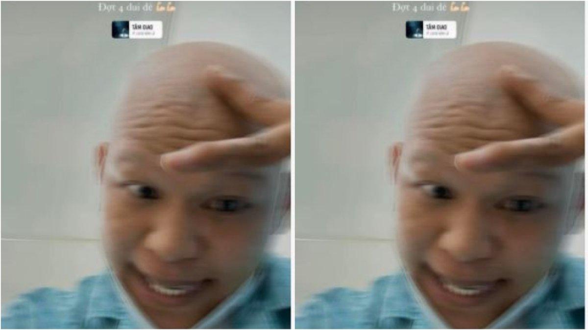 Artis Long Nong Na kemoterapi (1)