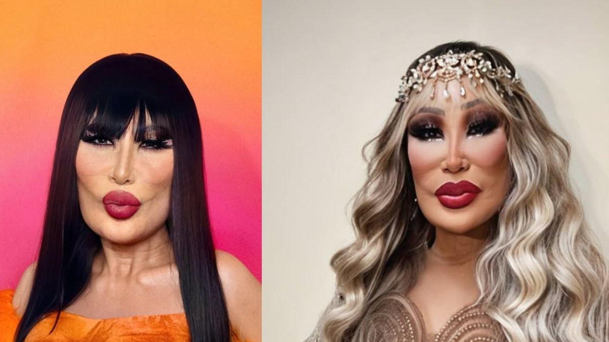 ARTIS GAGAL FILLER - Foto tangkapan layar dari Instagram @lyn_may_ , Kamis (26/6/2025). Artis Meksiko bernama Lyn May gagal filler, kini penampilannya jauh dari ekspektasi.