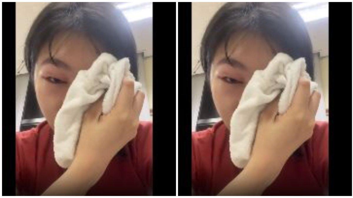 Artis nangis matanya bengkak jelang manggung (1)