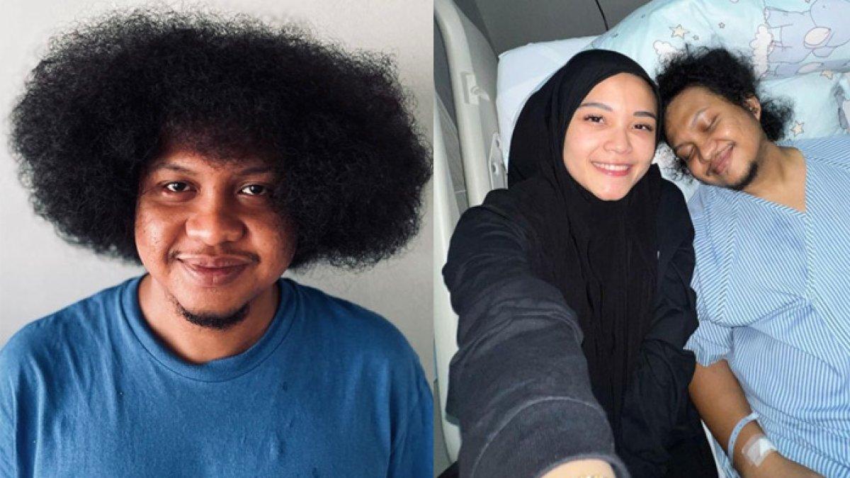 Babe Cabita meninggal dunia karena anemia aplastik