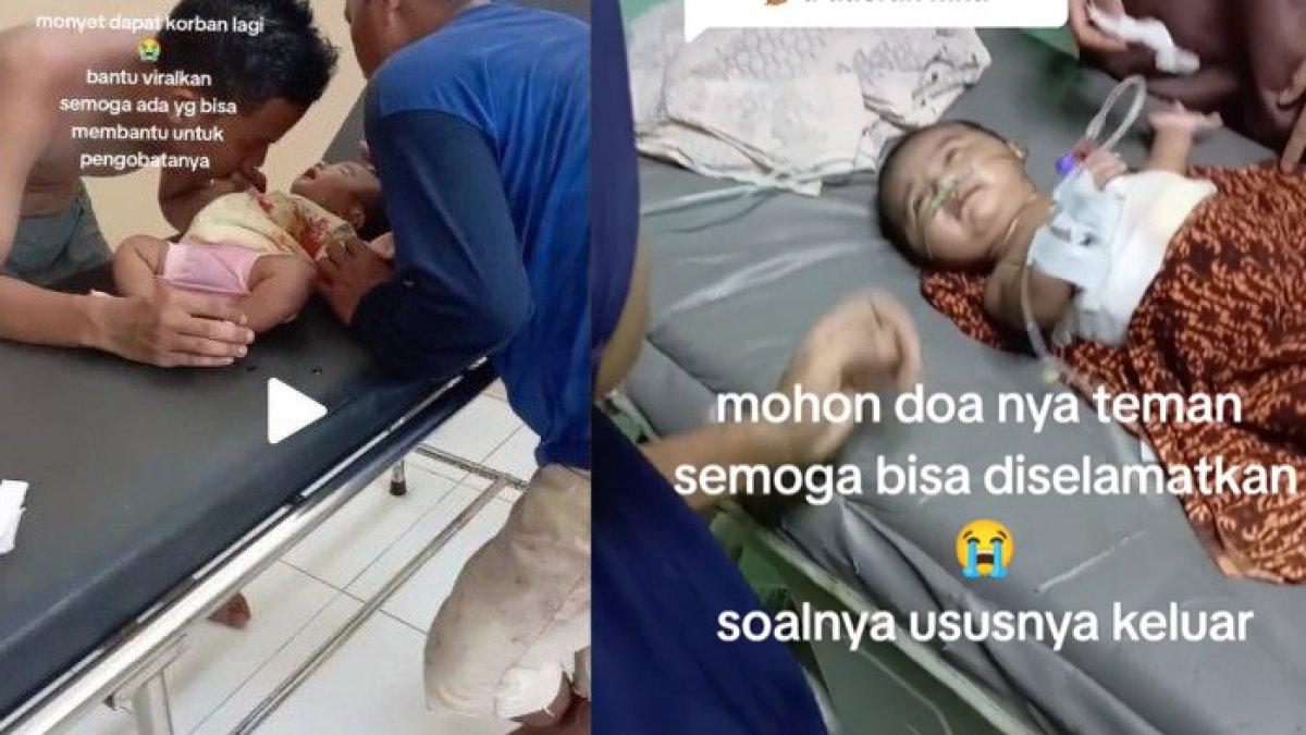 Bayi 2 bulan di Lebak, Banten, digigit monyet, kondisinya miris