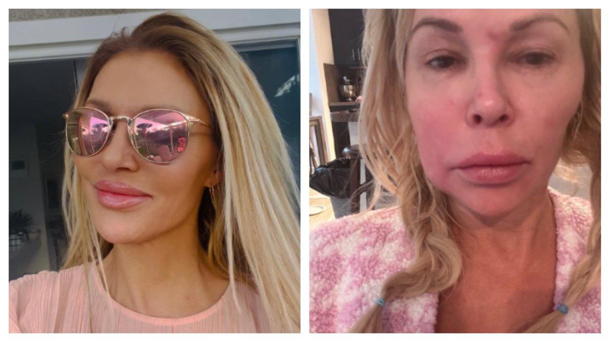 Bintang Reality Show Brandi Glanville Rela Rogoh Kocek Rp1,1 M Demi Wajah Kembali Cantik