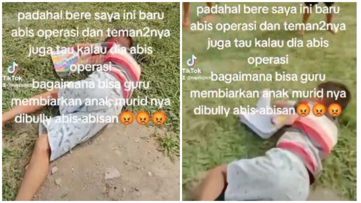 Bocah di Simalungun, Sumut, dibully temannya