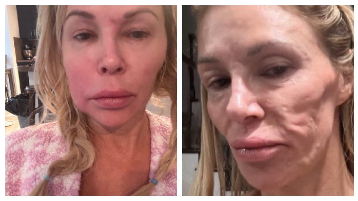 Bintang Reality Show Brandi Glanville Rela Rogoh Kocek Rp1,1 M Demi Wajah Kembali Cantik