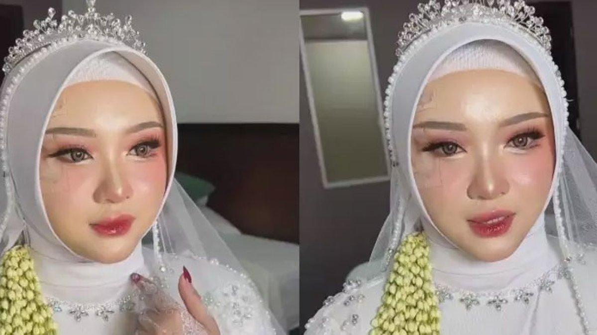 Calon pengantin kecelakaan jelang hari nikahan, untung bisa ditutup make up