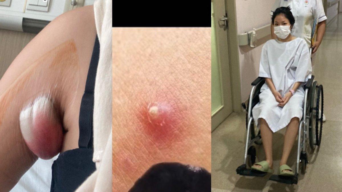 Cherry Tefani harus operasi ketiak gara-gara waxing