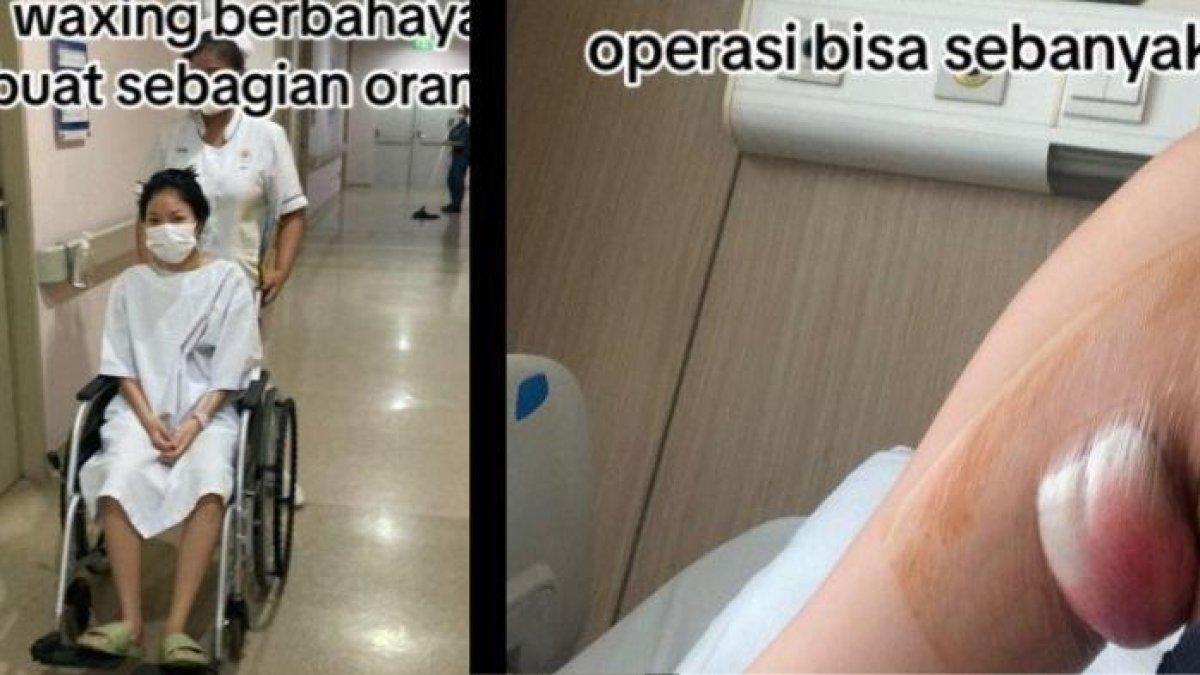 Cherry Tefani harus operasi ketiak gara-gara waxing