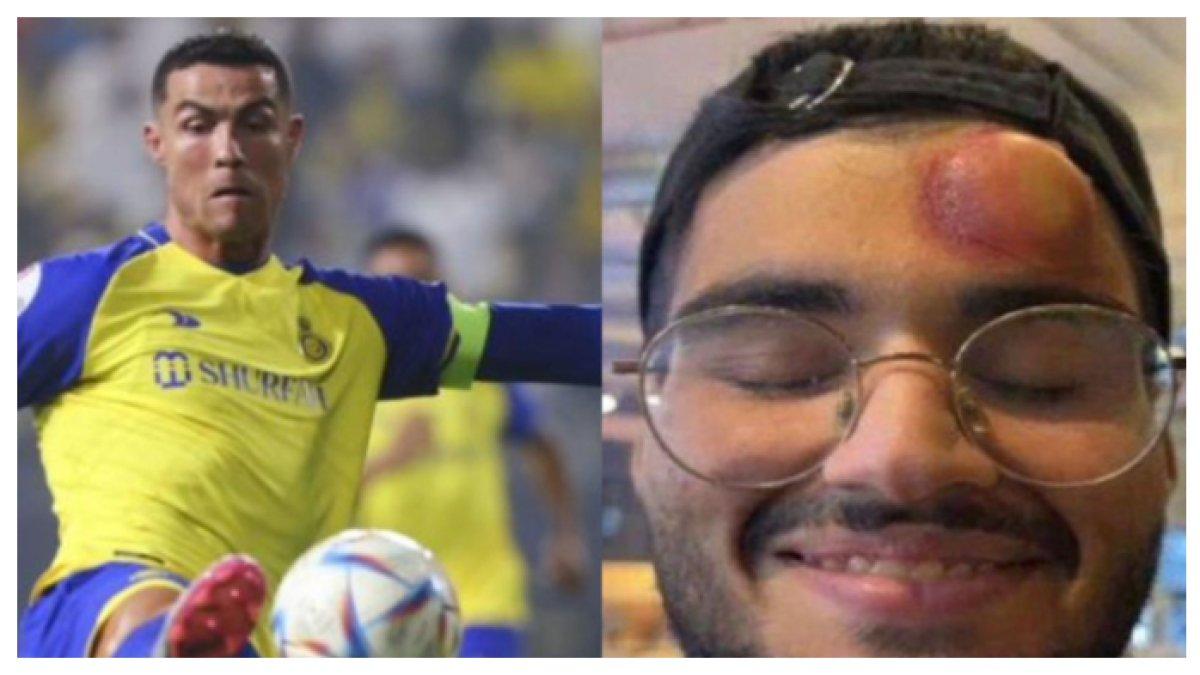 Kameramen yang terkena bola dari tendangan bebas Cristiano Ronaldo.